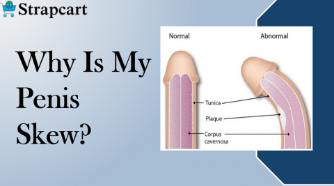 Why is my penis skew?