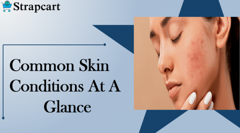 Common Skin Conditions at a Glance